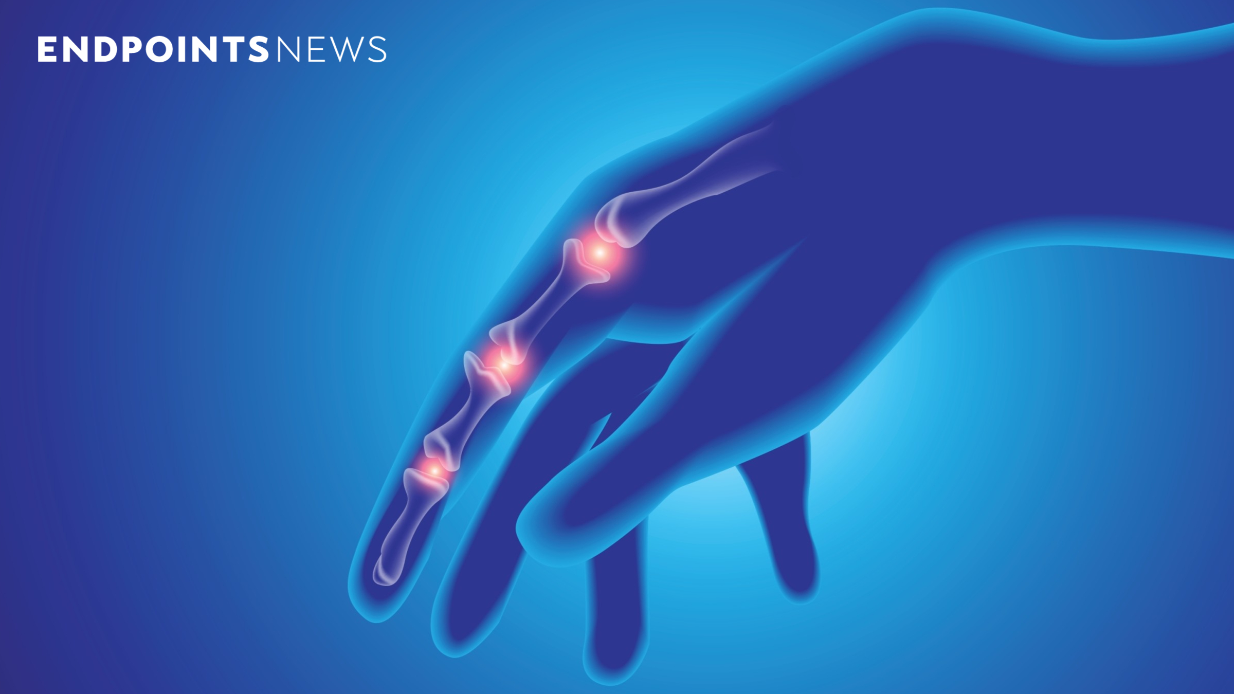 AnaptysBio gets a mid-stage win for PD-1 drug in rheumatoid arthritis