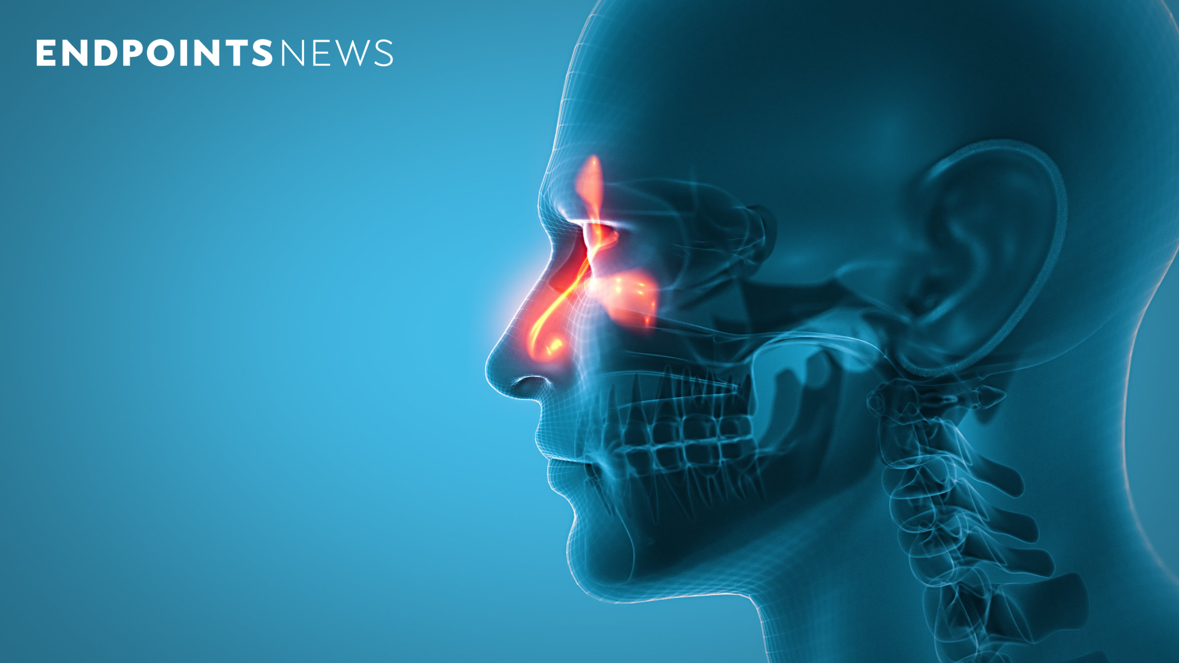 GSK, Amgen and AstraZeneca tout Phase 3 data in inflammatory nasal condition 