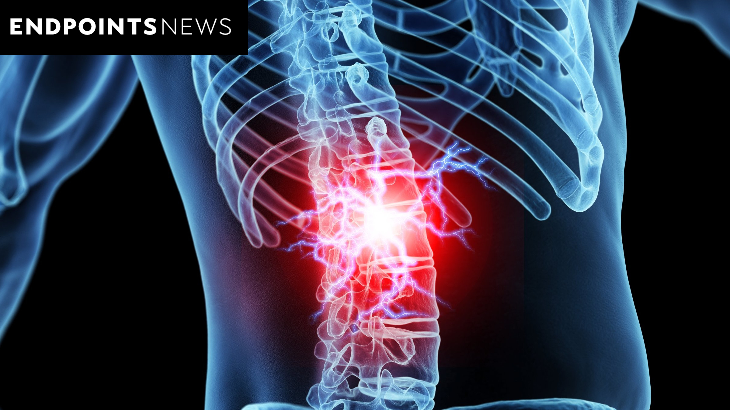 Persica shares early data for antibiotic in chronic back pain